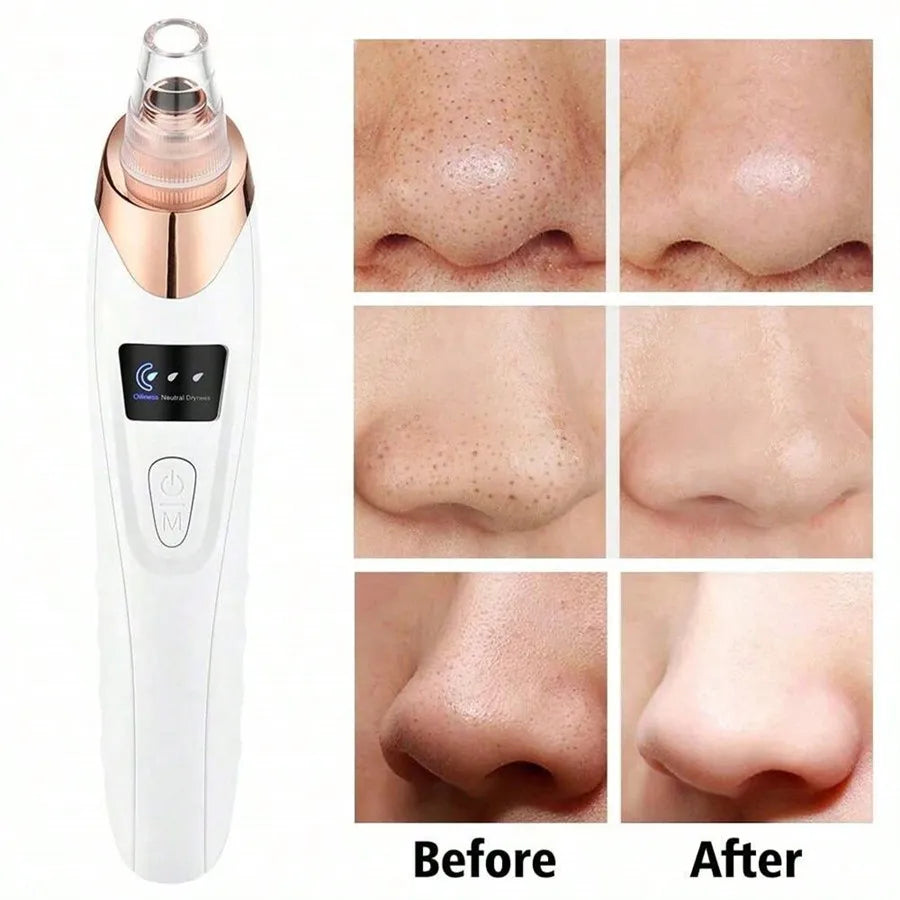 Electric Pore Vacuum Cleanser