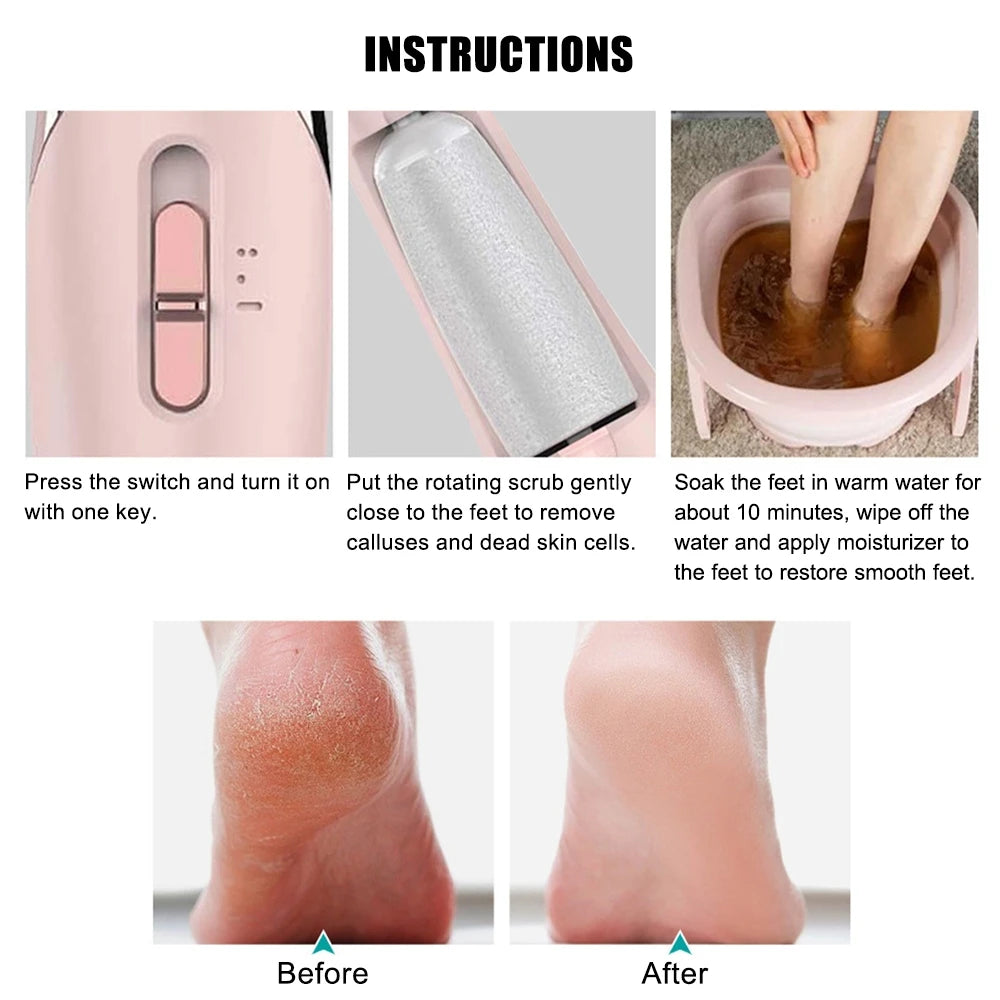 Electric Callus Remover