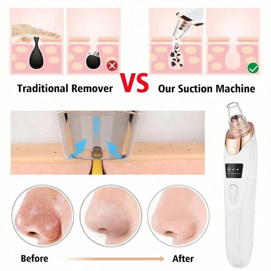 Electric Pore Vacuum Cleanser