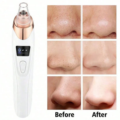 Electric Pore Vacuum Cleanser