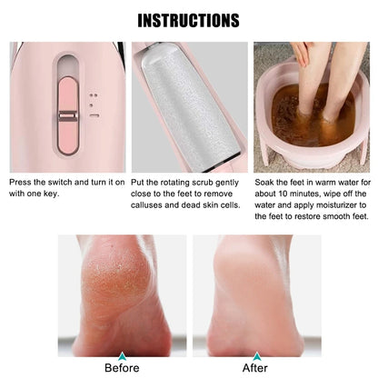 Electric Callus Remover